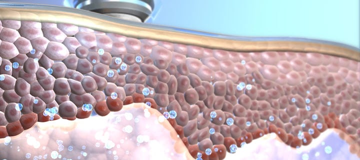 Oxygeneo