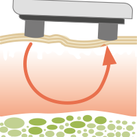 Faltenbehandlung